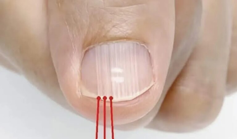 Ако имате такива линии по ноктите, това е явен признак за това, че…